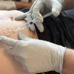 Лікарі допоможуть військовому позбутися зробленого росіянами страшного напису на тілі